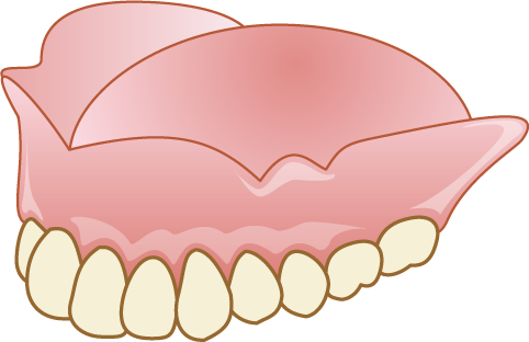 入れ歯 上顎