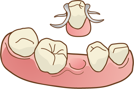 入れ歯 下顎