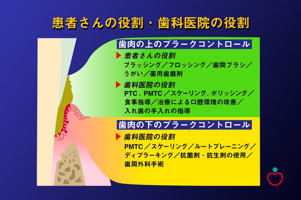 歯周病の治療について いずみ中山歯科