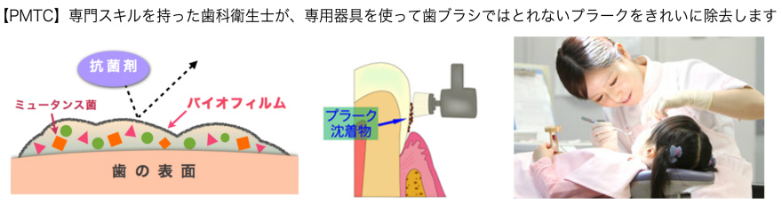 PMTCイメージ